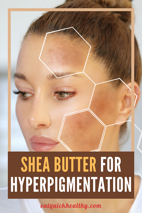 How To Use Shea Butter For Skin Discoloration